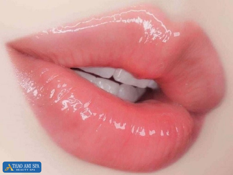Phun môi collagen mang đến cho bạn đôi môi căng mọng đầy quyến rũ