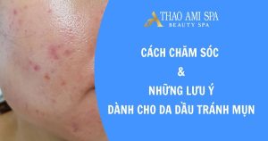 Cách chăm sóc da dầu mụn