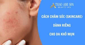 Cách chăm sóc (skincare) dành riêng cho da khô mụn