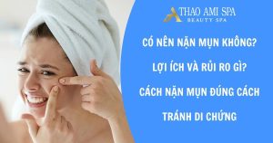 Có nên nặn mụn không?