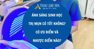 Ánh sáng sinh học trị mụn có tốt không?