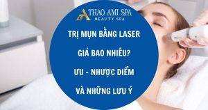 Điều trị mụn bằng laser có tốt không? giá bao nhiêu? ưu và nhược điểm?