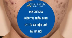 Địa chỉ spa điều trị thâm mụn uy tín và hiệu quả tại Hà Nội