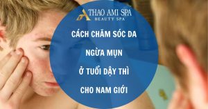 Cách chăm sóc da ngừa mụn tuổi dậy thì ở nam giới