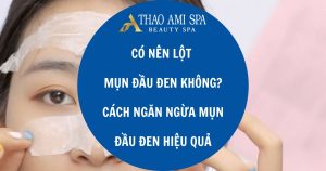 Có nên lột mụn đầu đen không?