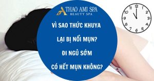 Đi ngủ sớm có hết mụn không?