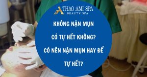 Không nặn mụn có tự hết không?