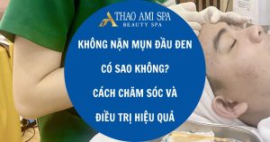 Không nặn mụn đầu đen có sao không? Cách chăm sóc và điều trị mụn đầu đen hiệu quả