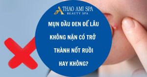 Tác hại xấu cho da bởi thói quen nặn mụn