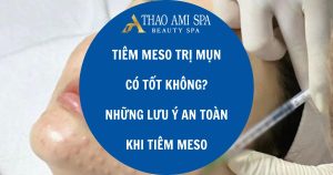 Tiêm meso trị mụn và những lưu ý an toàn khi tiêm meso