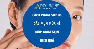 Cách chăm sóc da dầu mụn mùa hè giúp giảm mụn hiệu quả