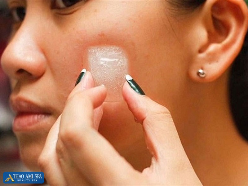 Làm sạch mặt và chườm đá giúp dịu da