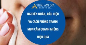 Nguyên nhân, dấu hiệu và cách phòng tránh miệng cám quanh miệng