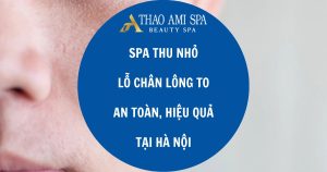 Spa điều trị lỗ chân lông to tại Hà Nội