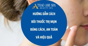 Hướng dẫn bôi thuốc trị mụn đúng cách