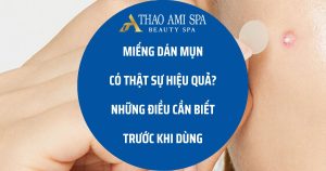 Những điều cần biết trước khi dùng miếng dán mụn