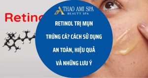 Retinol có trị mụn không?