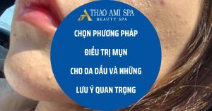 Chọn thuốc trị mụn cho da dầu cần lưu ý gì?