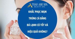 Khắc phục mụn bằng đá lạnh có tốt không?