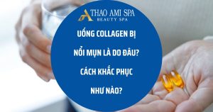 Uống Collagen bị nổi mụn do đâu?