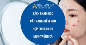 Cách chăm sóc và trang điểm phù hợp cho da mụn