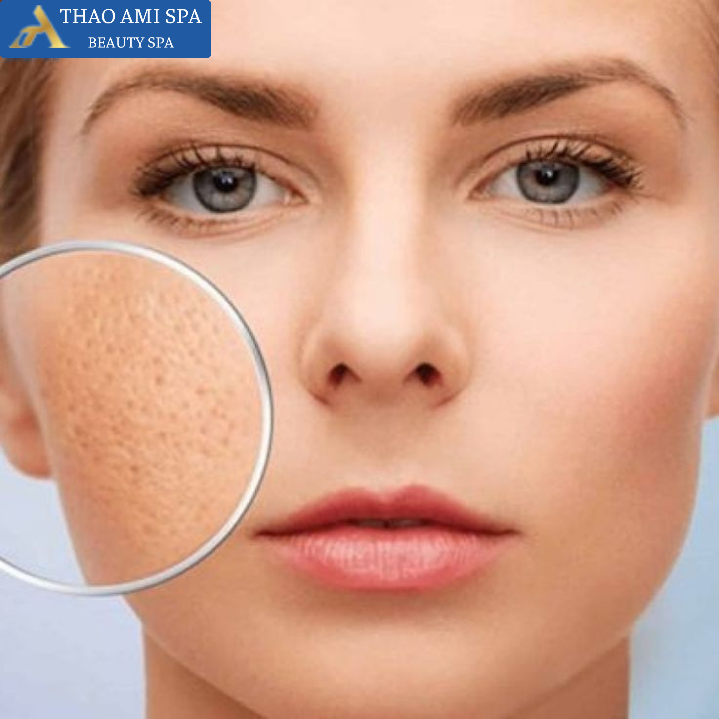 Lỗ chân lông to