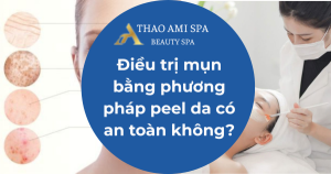 Điều trị mụn bằng phương pháp peel da có an toàn không