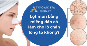 Lột mụn bằng miếng dán có làm cho lỗ chân lông to không