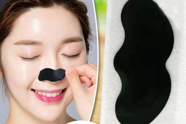 Lột mụn bằng miếng dán
