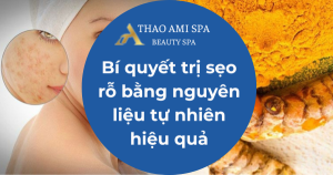 Bí quyết trị sẹo rỗ bằng nguyên liệu tự nhiên hiệu quả