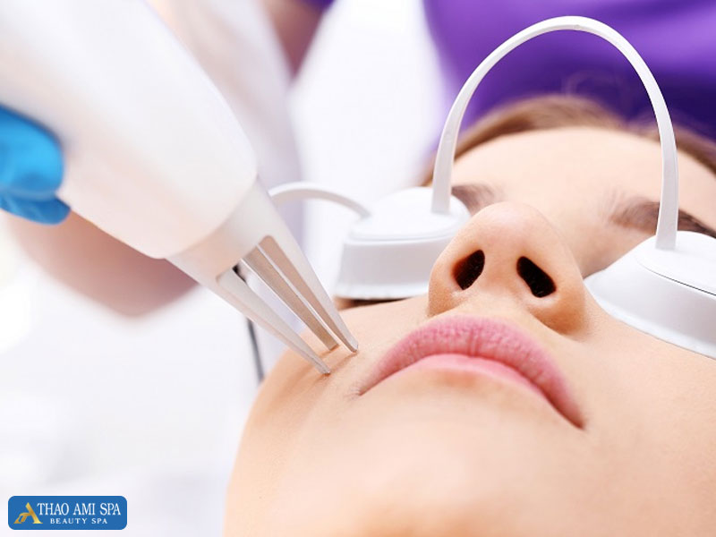 Công nghệ laser Fractional CO2:PICO trị sẹo thuỷ đậu