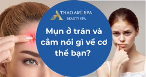 Mụn ở trán và cẳm nói gì về cơ thể bạn