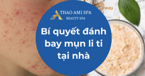 Bí quyết đánh bay mụn li ti tại nhà
