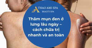 Thâm mụn đen ở lưng lâu ngày – cách chữa trị nhanh và an toàn