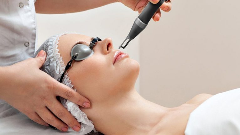 Điều trị mun đầu đen bằng laser