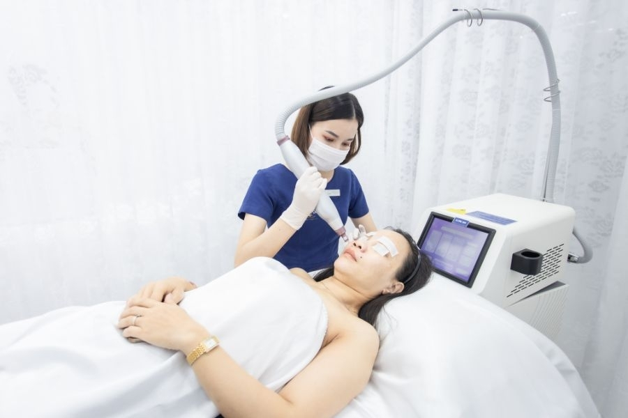 Meso trị vết chân chim